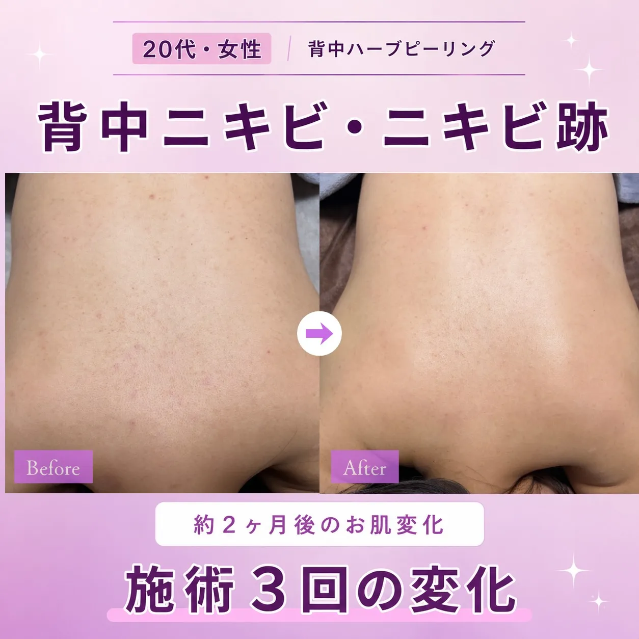 汗をかきやすい季節💦